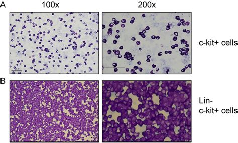 Toluidine Blue Staining Of Macs Separated Peritoneal Cells