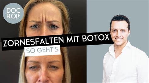 Zornesfalte Mit Botox Behandeln Darauf Muss Man Achten Dr Rolf