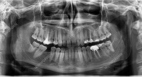 Panoramic Dental X Ray — Stock Photo © Marincasandrei 11513103