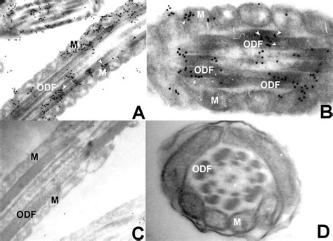 Transmission Electron Micrographs Of Ultrathin Sections Of Bovine