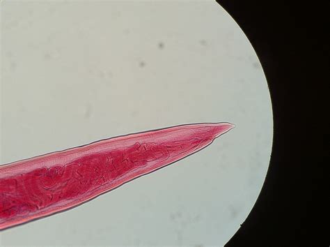 Ancylostoma Caninum Female 5 Dralashiekh Flickr