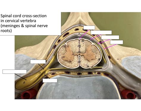 SpinalCord Cross-Section in cervical vertebra (m Quiz