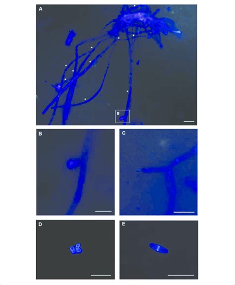 Microscopical Analysis Of Calcofluor Stained Fungal Cells Using 4 Download Scientific Diagram