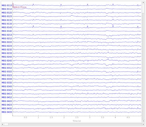 Overview Of Meg Eeg Analysis With Mne Python Mne Documentation