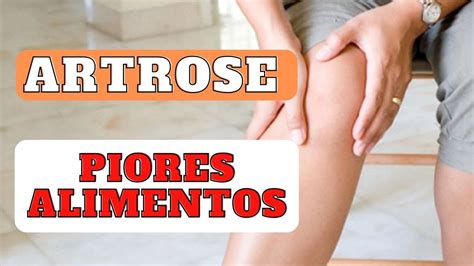 OS PIORES ALIMENTOS PARA QUEM TEM ARTROSE YouTube