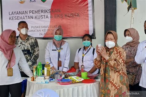 Mensos Hapus Stigma Penderita Kusta Di Kei Besar Ajak Berwirausaha