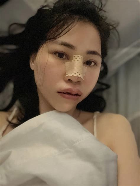 Thơ Nguyễn tiếp tục dao kéo phá banh hết mũi đến môi Bảo Ngọc hết đọ nhan sắc Hot KOLs