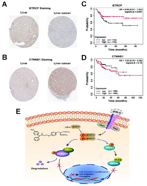 Correlation Of β Catenin And β Trcp Expression With Human Hcc Download Scientific Diagram