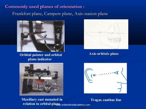 Hinge Axis Certified Fixed Orthodontic Courses By Indian Dental Acad