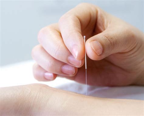 Treatment Townsend Acupuncture