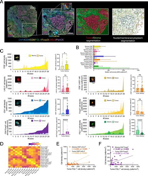 Impact Of Lag Fgl Pathway On Immune Evasive Contexture And Clinical