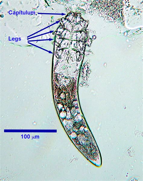 Demodex canis - Learn About Parasites - Western College of Veterinary ...