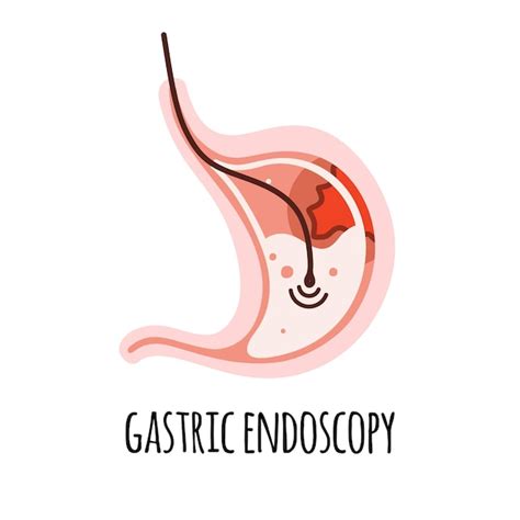 Premium Vector Endoscopy The Stomach Of A Person With An Ulcer