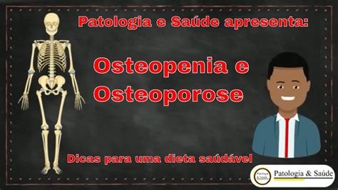 Osteopenia E Osteoporose Qual A Diferen A Youtube