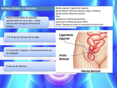 Hernias De La Pared Abdominal Eventracion Y Eviceracion