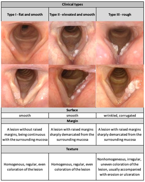 Jcm Free Full Text Videolaryngoendoscopic And Stroboscopic