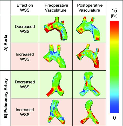 Wall shear stress (WSS) measured in pascals of tissueengineered ...