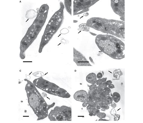 Transmission Electron Micrographs Demonstrating Structural Variability