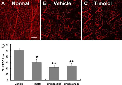 Quantification Of Rgc Loss In Mice Ac Representative Download