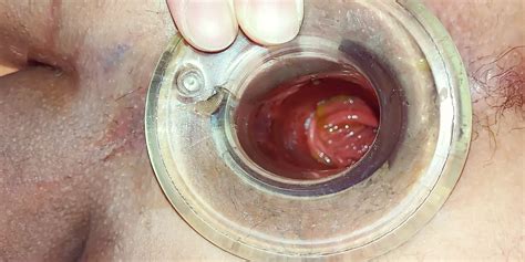 Tunnel Plug Gay Gaping Gaping Porn Feat Oilifant XHamster