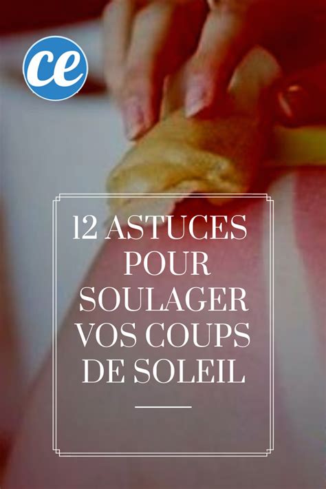 12 Astuces Surprenantes Pour Soulager Vos Coups De Soleil Coup De