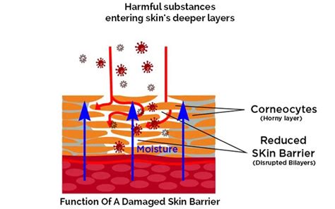 Why You Need To Protect Your Skin Barrier Skinkraft