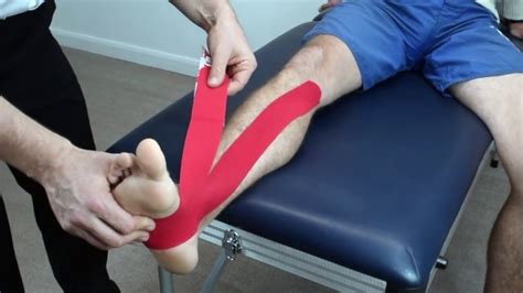 How To Tape Posterior Tibialis Tendon For Pain Relief With Kinesiology