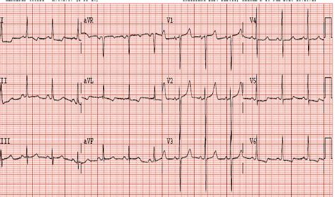 Dr. Smith's ECG Blog: July 2010