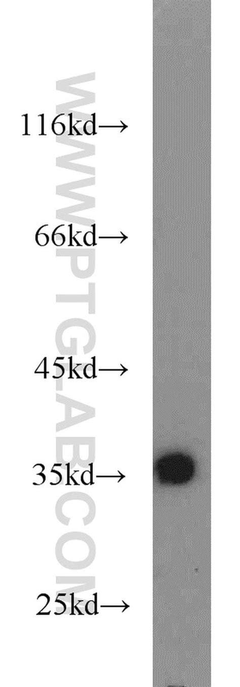 Tpa Rabbit Anti Human Mouse Rat Polyclonal Proteintech L