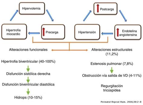 Síndrome De Transfusión Feto Feto Resultados Neonatales En Un Hospital