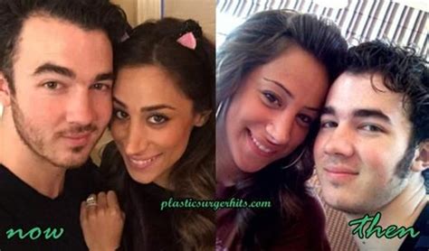 Danielle Jonas Plastic Surgery Through Nose Job Fact Or Rumor Danielle Jonas Nose Job