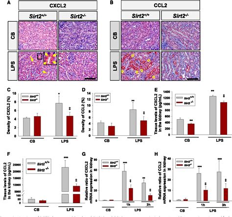 Figure From Sirt Regulates Lps Induced Renal Tubular Cxcl And Ccl