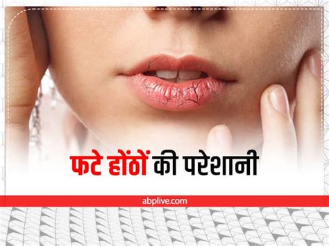 How To Make Lips Pink And Soft Dry Lips Remedies सर्दियों में फटे होंठों से हैं परेशान इन