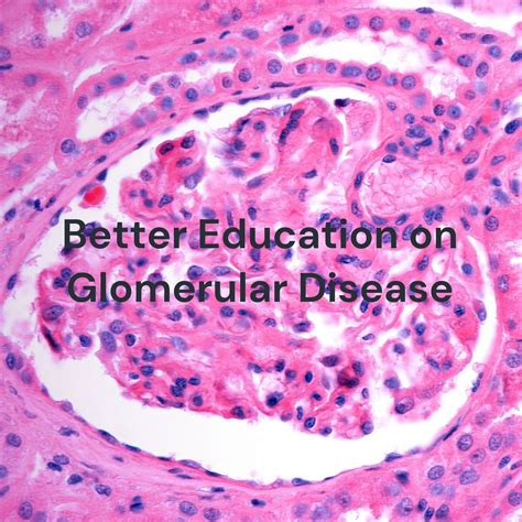 Glomerular Disease By Better Education On Glomerular Disease Improving