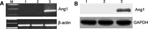 Expression Of Exogenous Angiopoietin 1 In Mesenchymal Stem Cells A