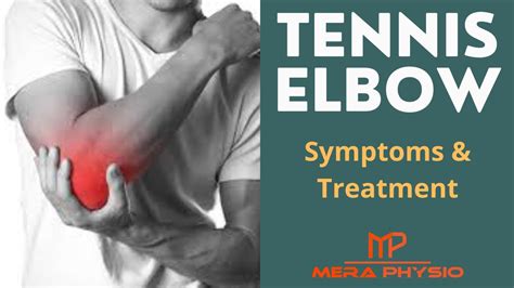 Tennis Elbow Lateral Epicondylitis Causes Symptoms Treatment