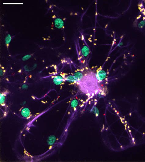 Simultaneous Visualization Of Plant Energy Organelles And Actin In Download Scientific Diagram