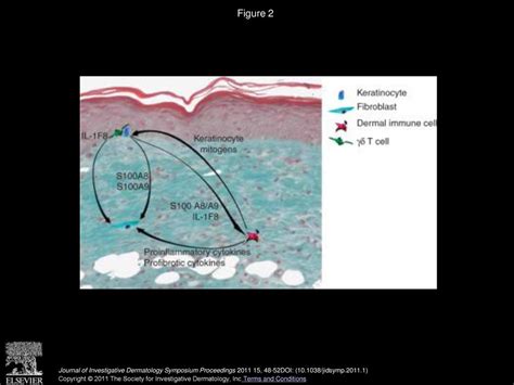 The Role Of Chronic Inflammation In Cutaneous Fibrosis Fibroblast