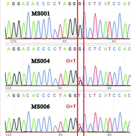 Validation Via Sanger Sequencing The G T Variant Identified In Three