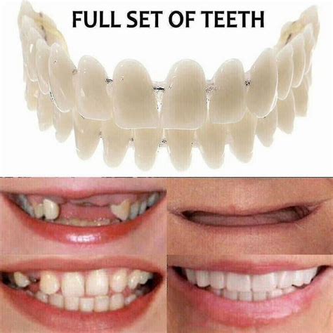 Smile Snap On False Teeth Upper Lower Dental Veneers Dentures Tooth Cover Set Hc51-3 Hk ...