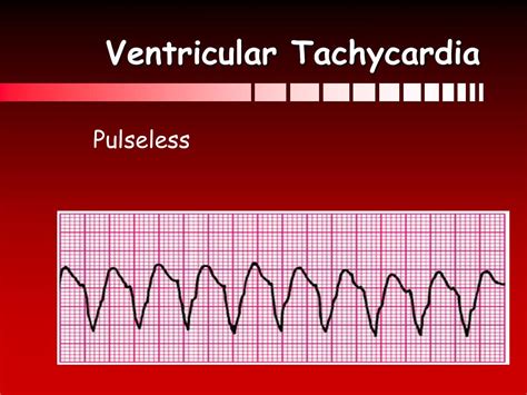 Ppt Acls Ob Powerpoint Presentation Free Download Id724540