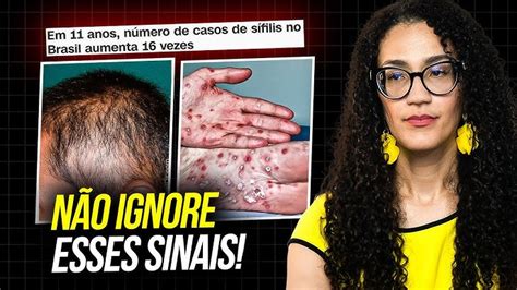 Como É Sifilis Na Mulher - Sifilis Primaria Feminina Biolab | A Sífilis é Uma Infecção