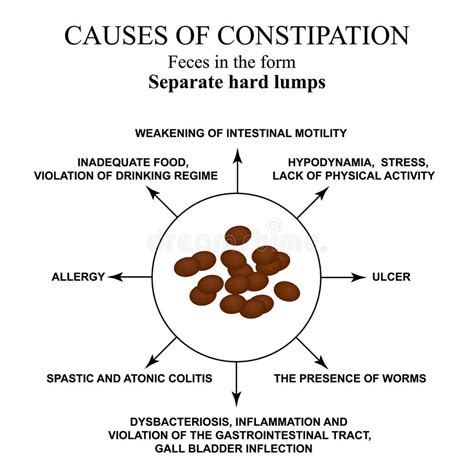 Sheep Digestive System Stock Illustrations – 20 Sheep Digestive System ...