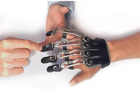 Finger Prosthetics