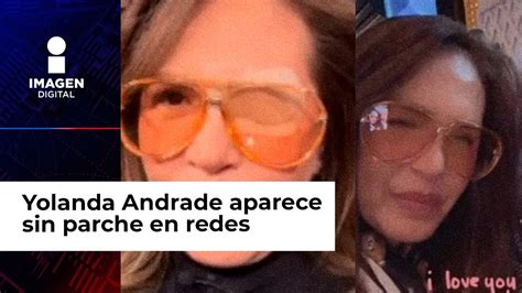 Yolanda Andrade Aparece En Redes Sociales Sin Parche En El Ojo Fans Se