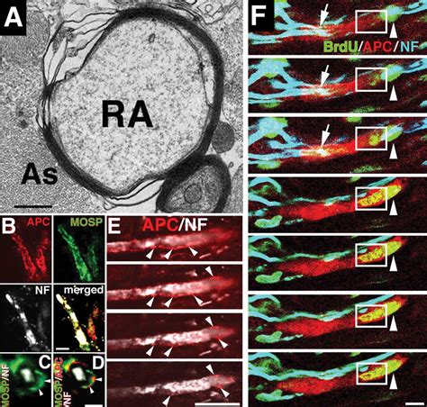 Demyelination And Remyelination After Primate Sci A Electron