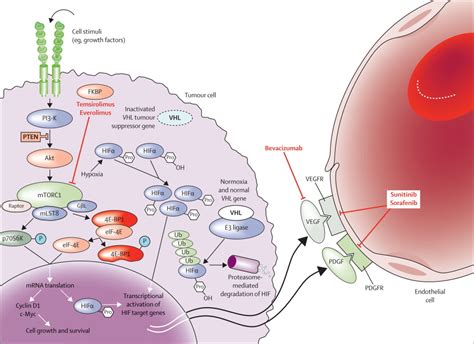 Renal Cell Carcinoma The Lancet