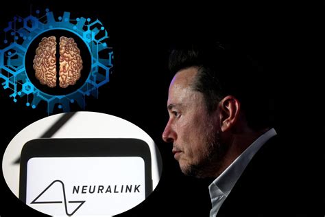 Elon Musk anuncia primera implantación de chip en un cerebro humano