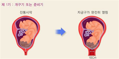 자연분만 출산 과정 출산에 걸리는 시간 네이버 블로그