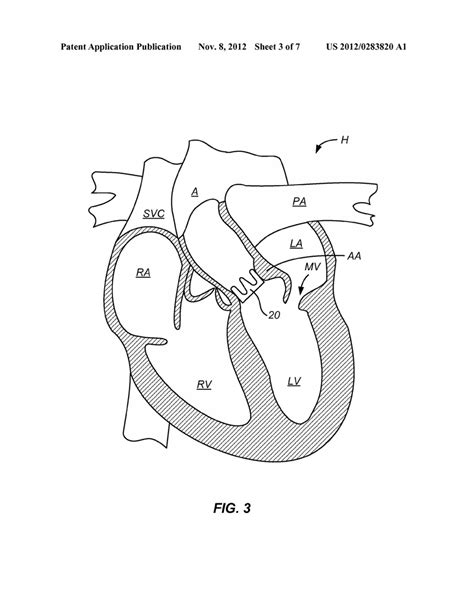 Download Simple Heart Diagram Blood Flow Gif | Diagram Anatomy